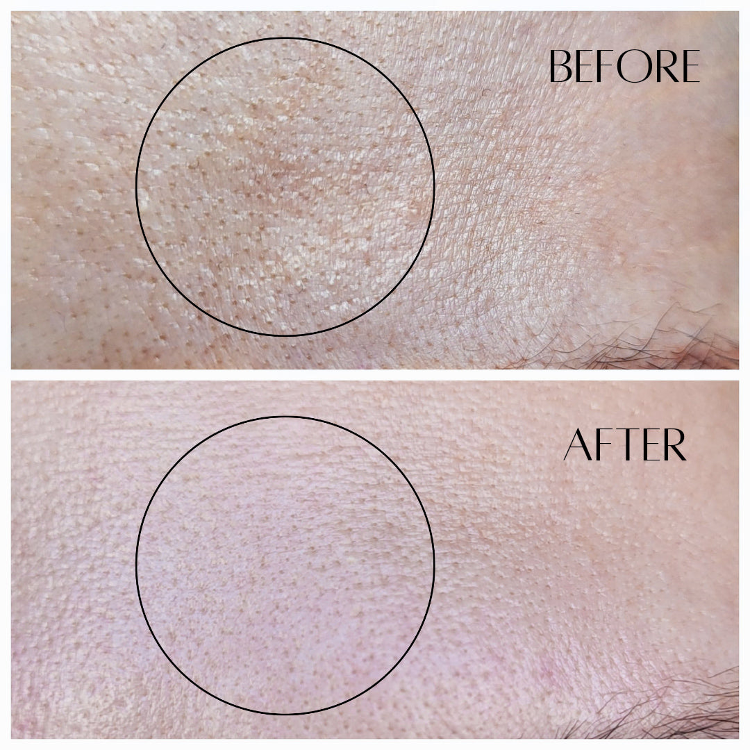 AHA + BHA Dermal Night Treatment