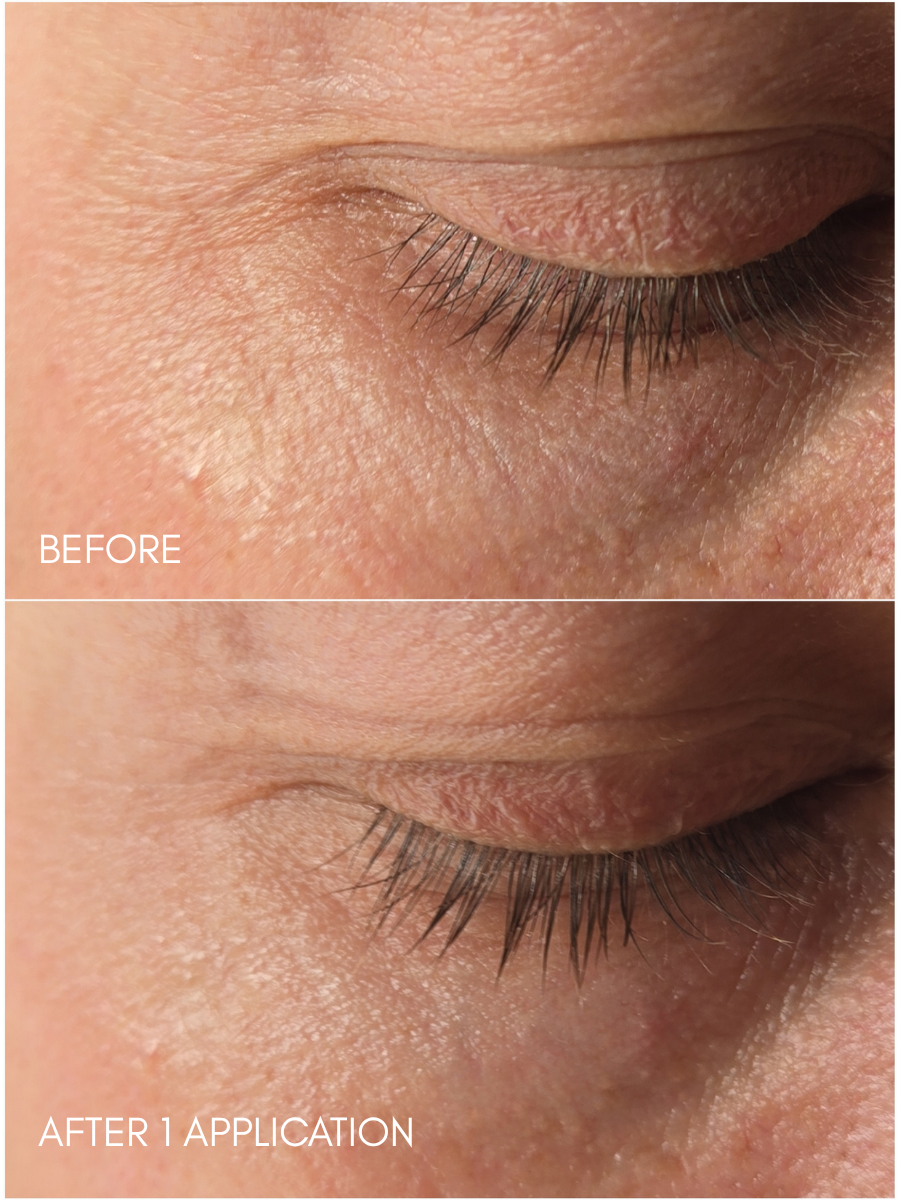 Bio-Peptide Eye Treatment