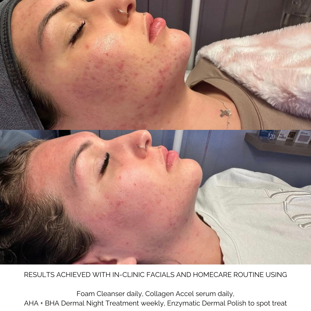Antioxidant Foam Cleanser