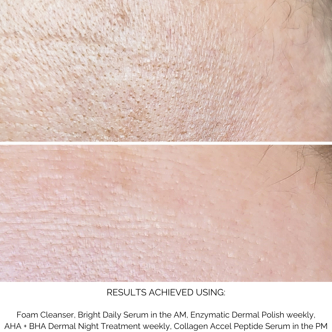 Antioxidant Foam Cleanser