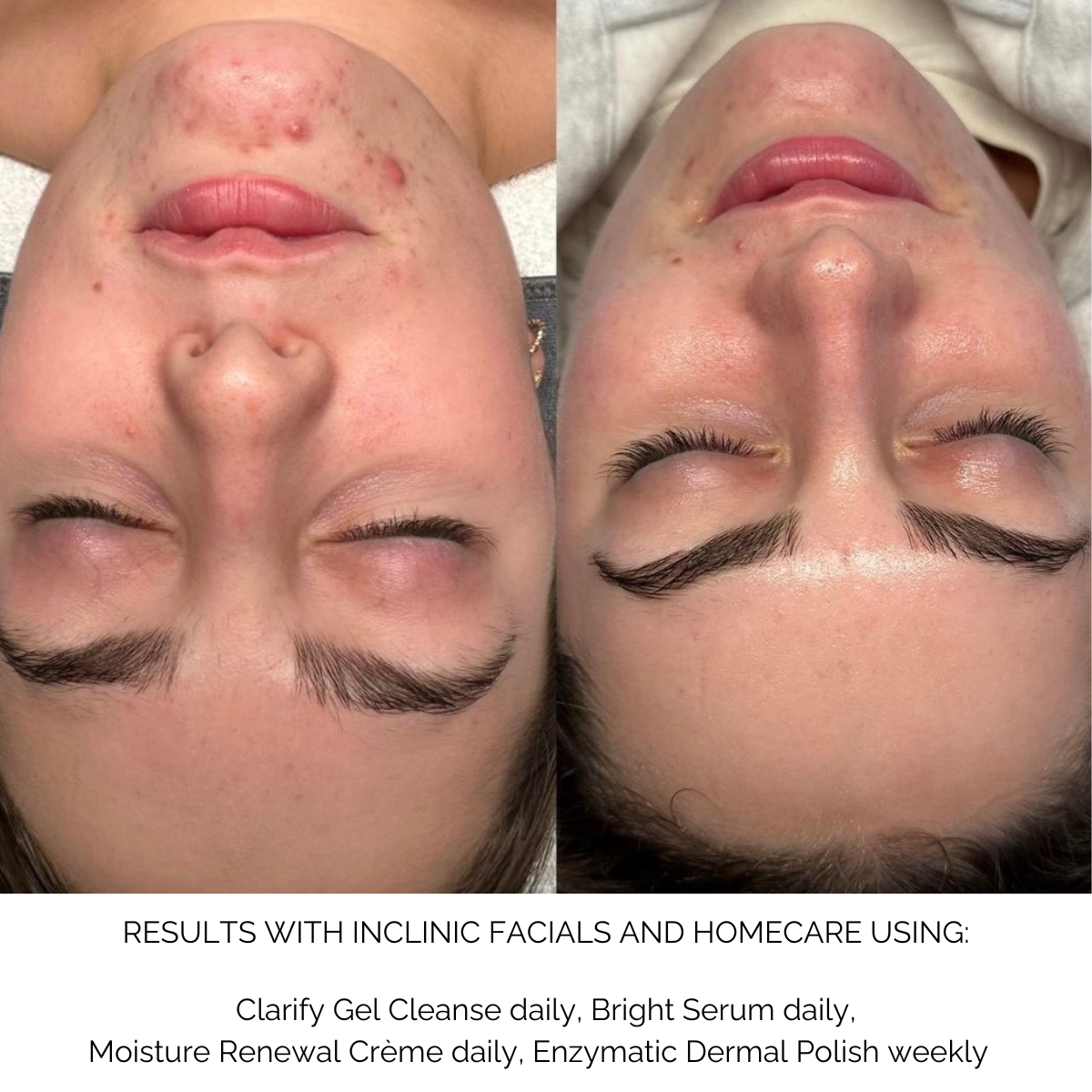 Moisture Renewal Crème- lightweight hydration