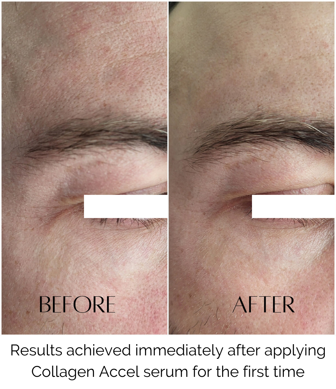 Collagen Accel Serum- Peptide Complex & Hydrating Actives
